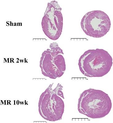 Ultrastructural Adaptation of the Cardiomyocyte to Chronic Mitral Regurgitation